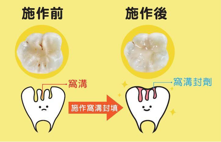 台南兒童牙醫診所推薦
