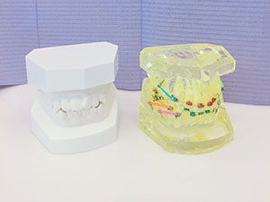 台南牙齒矯正診所推薦、台南齒顎矯正診所專科醫師